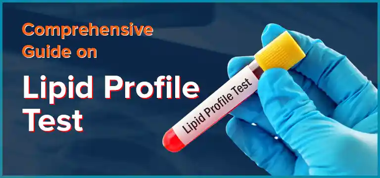 Comprehensive Guide on Lipid Profile Test